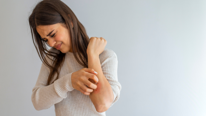 Jeune femme brune avec pull blanc qui a de l'eczéma sur l'avant-bras et se gratte en souffrant