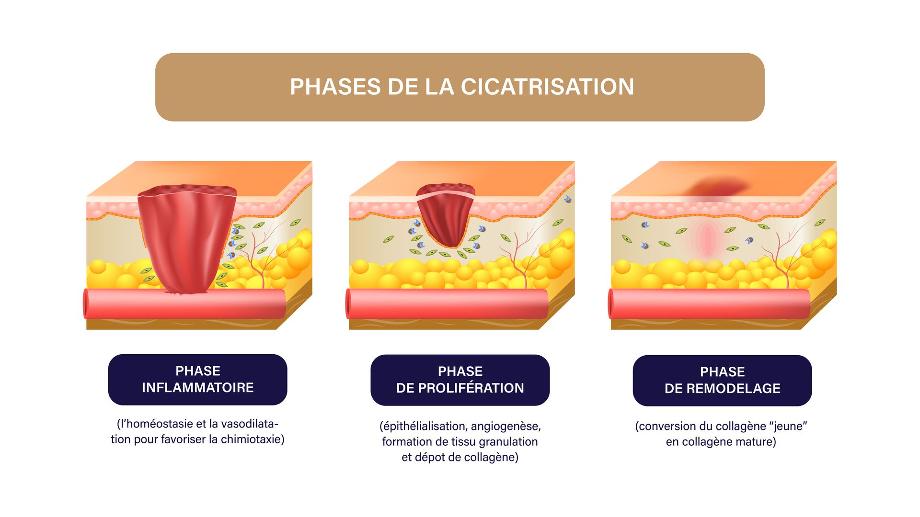 schéma cicatrisation 
