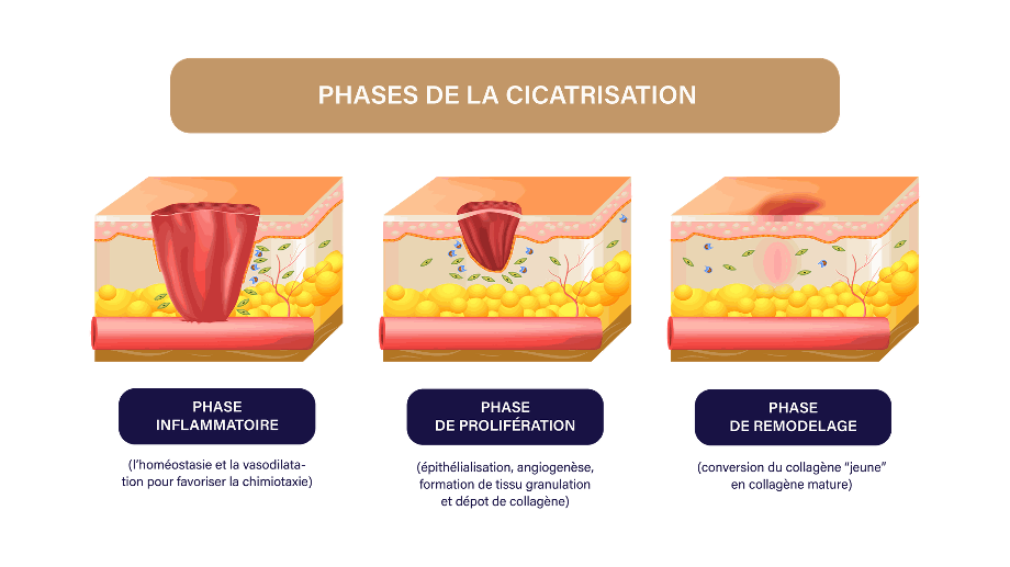 schéma cicatrisation