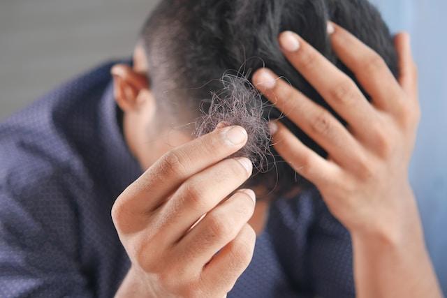 perte cheveux 